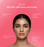 Woman with acne marks and text about skin conditions