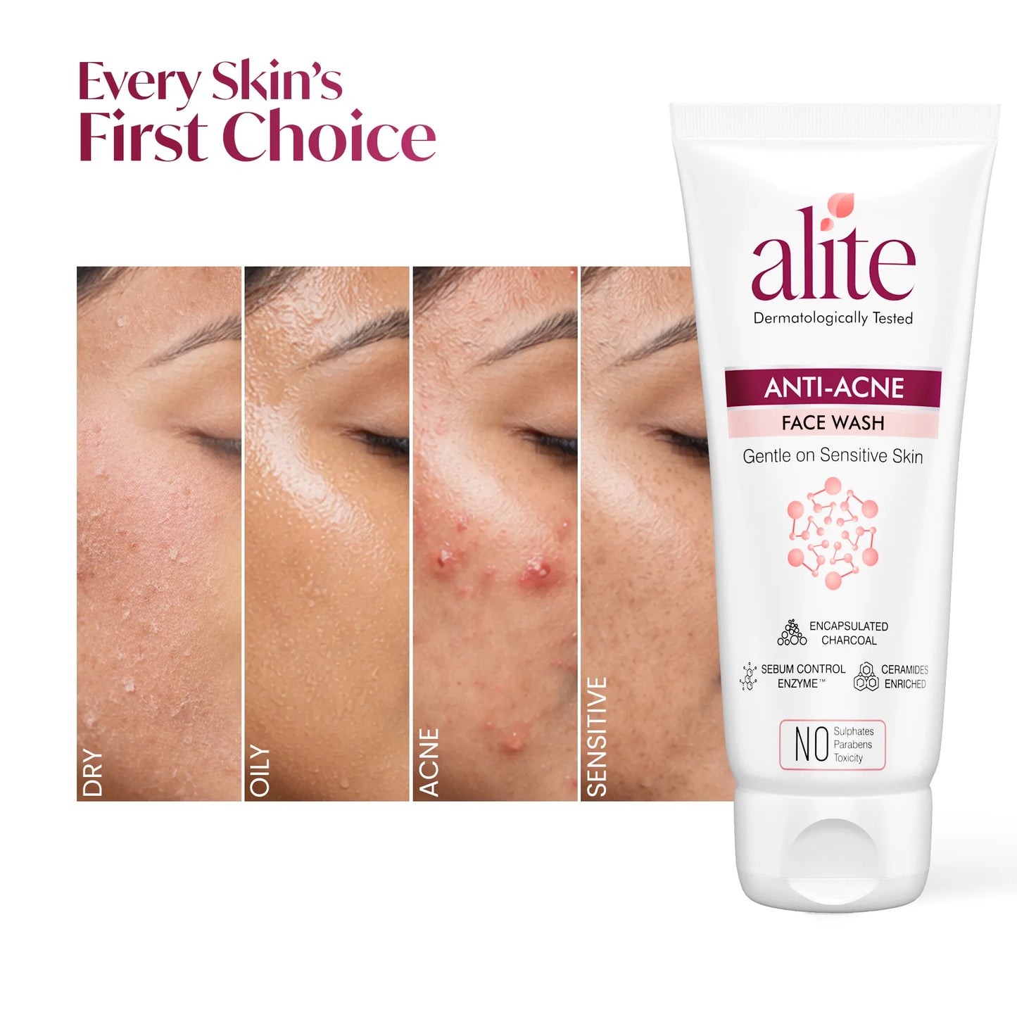 Alite Anti Acne Facewash 140g - Prevent Acne Breakouts & Control Oily Skin