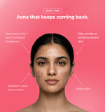 Woman with acne with text about skin conditions