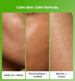 Three panels showing different skin conditions