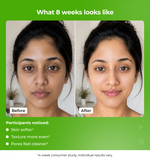 Before and after comparison of a womans face