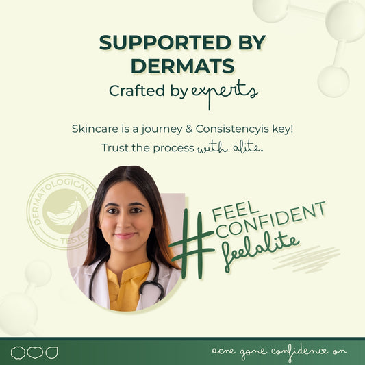 Alite Anti Acne Facewash 140g - Prevent Acne Breakouts & Control Oily Skin