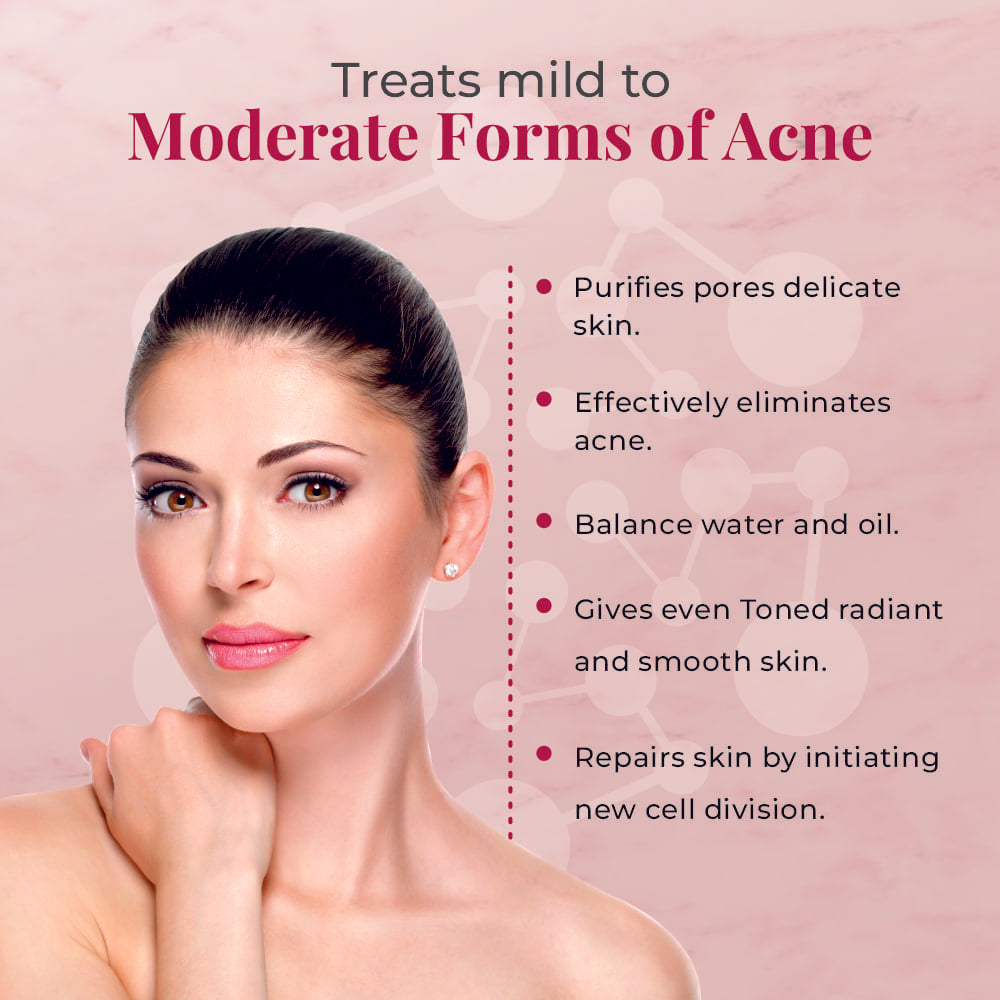 Treats mild to
Moderate Forms of Acne