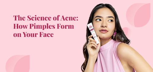 The Science of Acne: How Pimples Form on Your Face
