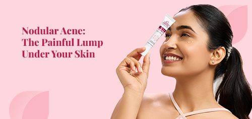 Nodular Acne: The Painful Lump Under Your Skin