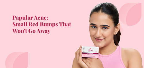 Papular Acne: Small Red Bumps That Won't Go Away