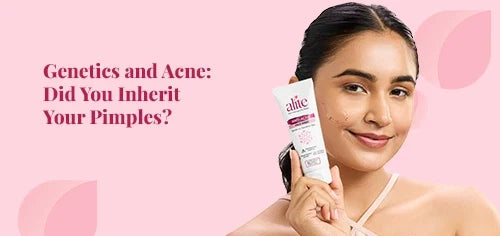 Genetics and Acne: Did You Inherit Your Pimples?