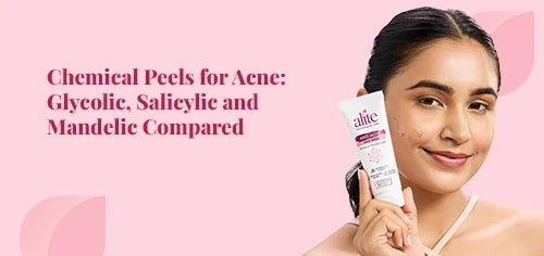 Chemical Peels for Acne: Glycolic, Salicylic and Mandelic Compared