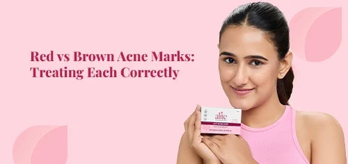 Red vs Brown Acne Marks: Treating Each Correctly
