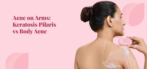 Acne on Arms: Keratosis Pilaris vs Body Acne