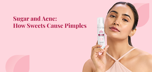 Sugar and Acne: How Sweets Cause Pimples