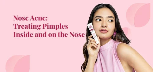 Nose Acne: Treating Pimples Inside and on the Nose