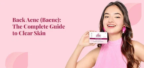 Back Acne (Bacne) The Complete Guide to Clear Skin
