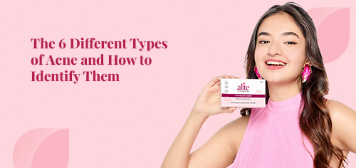 the 6 different types of acne and how to identify them