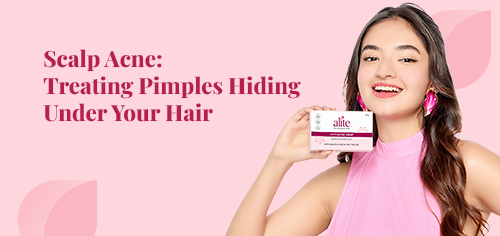 Scalp Acne: Treating Pimples Hiding Under Your Hair