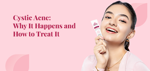 Cystic Acne: Why It Happens and How to Treat It