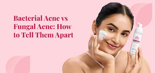 Bacterial Acne vs Fungal Acne: How to Tell Them Apart