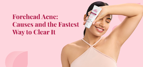 Forehead Acne: Causes and the Fastest Way to Clear It