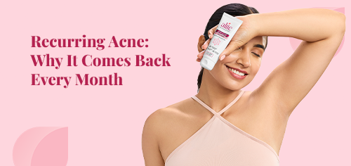 recurring acne