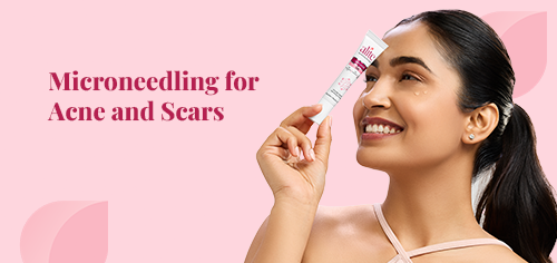 Microneedling for Acne and Scars