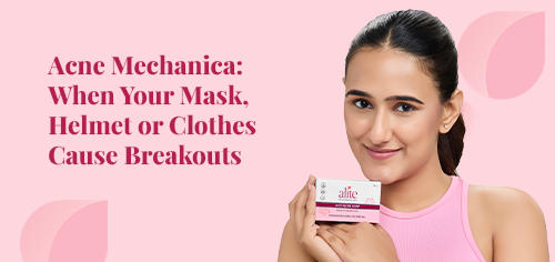 acne mechanica when your mask helmet or clothes cause breakouts