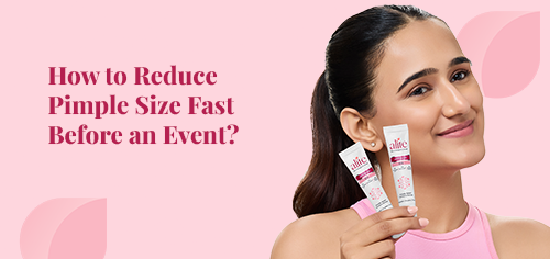 How to Reduce Pimple Size Fast Before an Event?