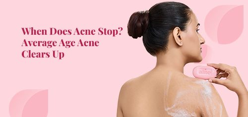 when does acne stop average age acne clears up
