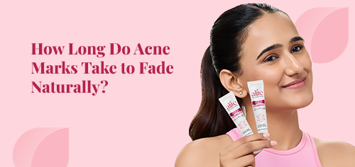 How Long Do Acne Marks Take to Fade Naturally?