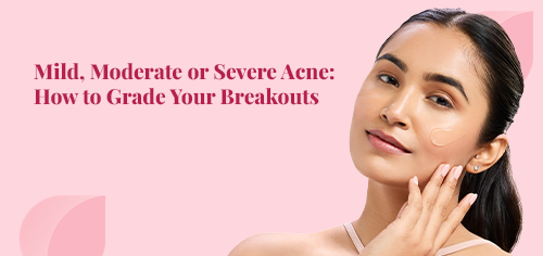 Mild, Moderate or Severe Acne: How to Grade Your Breakouts