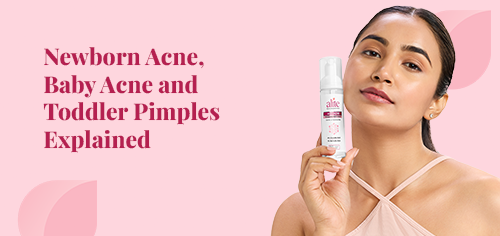 newborn acne baby acne and toddler pimples explained