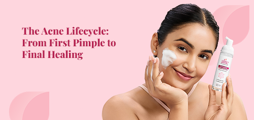 The Acne Lifecycle: From First Pimple to Final Healing
