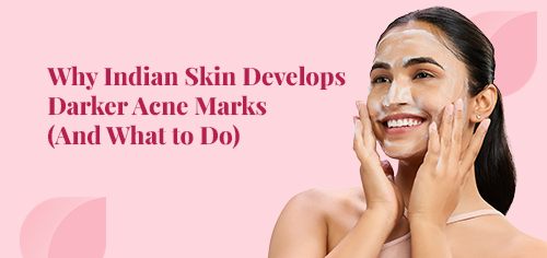 Why Indian Skin Develops Darker Acne Marks (And What to Do)