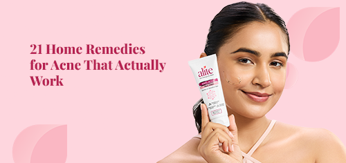 21 Home Remedies for Acne That Actually Work