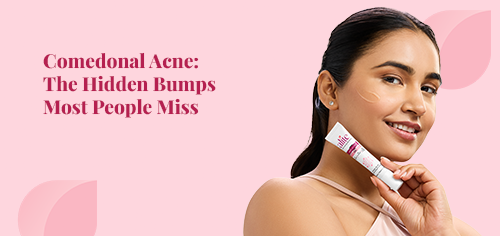 Comedonal Acne: The Hidden Bumps Most People Miss