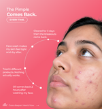 Person with acne  