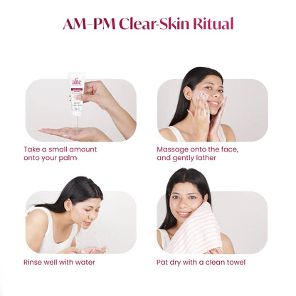 Alite Anti Acne Facewash 140g - Prevent Acne Breakouts & Control Oily Skin