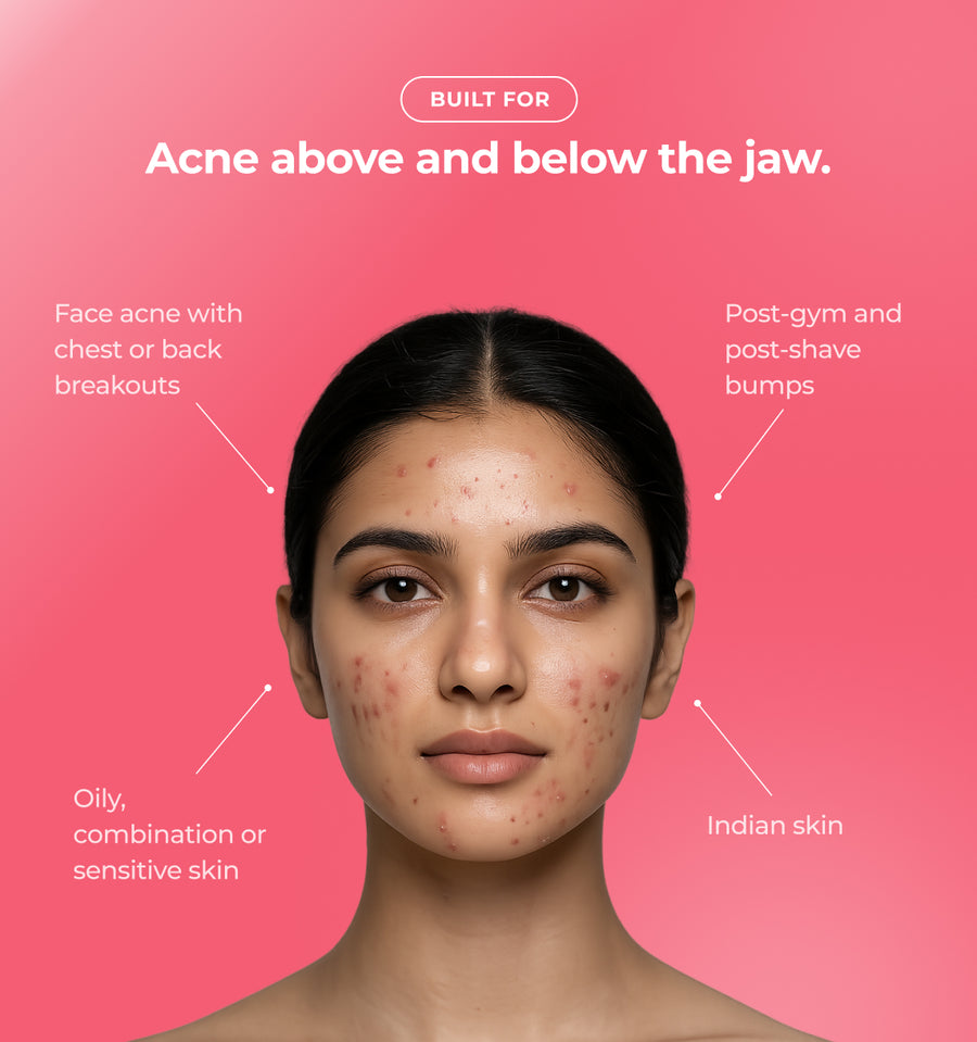 Woman with acne and text about skincare issues