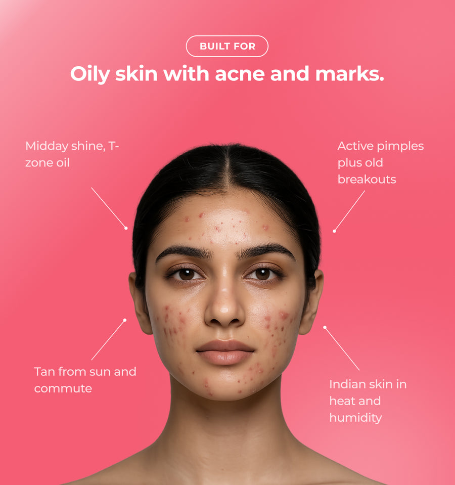Woman with acne marks and text about skin conditions