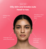 Woman with acne and text about oily skin and breakouts
