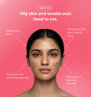 Woman with acne and text about oily skin and breakouts