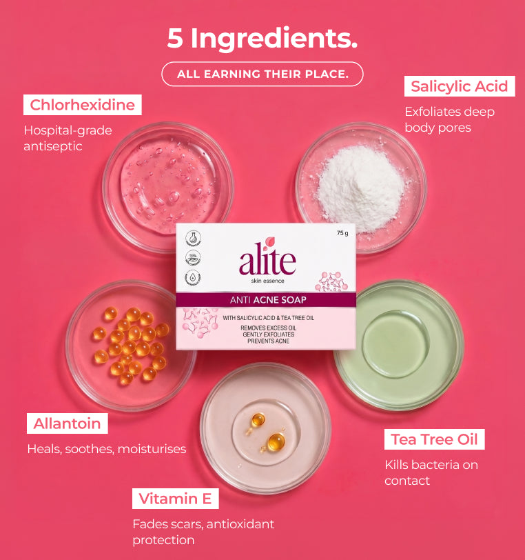 Alite anti acne soap packaging with ingredients displayed 