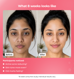 Before and after comparison of a womans face 