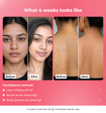 Before and after skin improvement results 