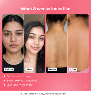 Before and after comparison of a woman' face and back 