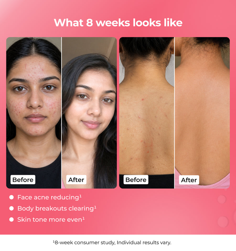 Before and after comparison of a woman' face and back 
