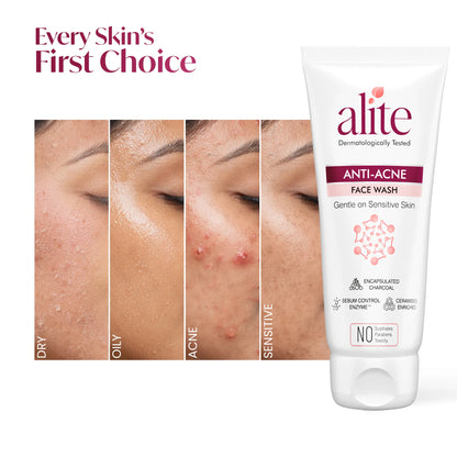 Alite Anti Acne Facewash 140g - Prevent Acne Breakouts & Control Oily Skin