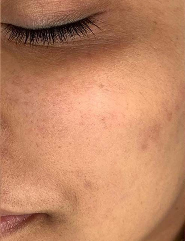 Sonal