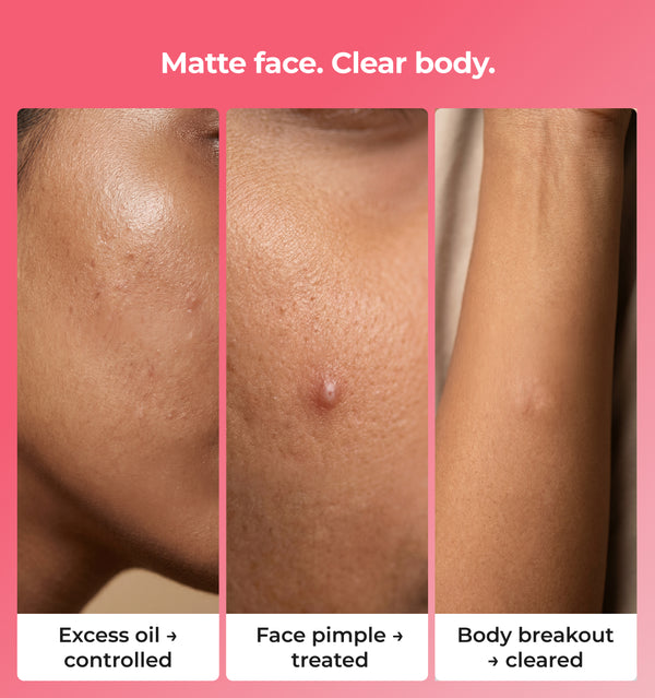 matte face clear body
