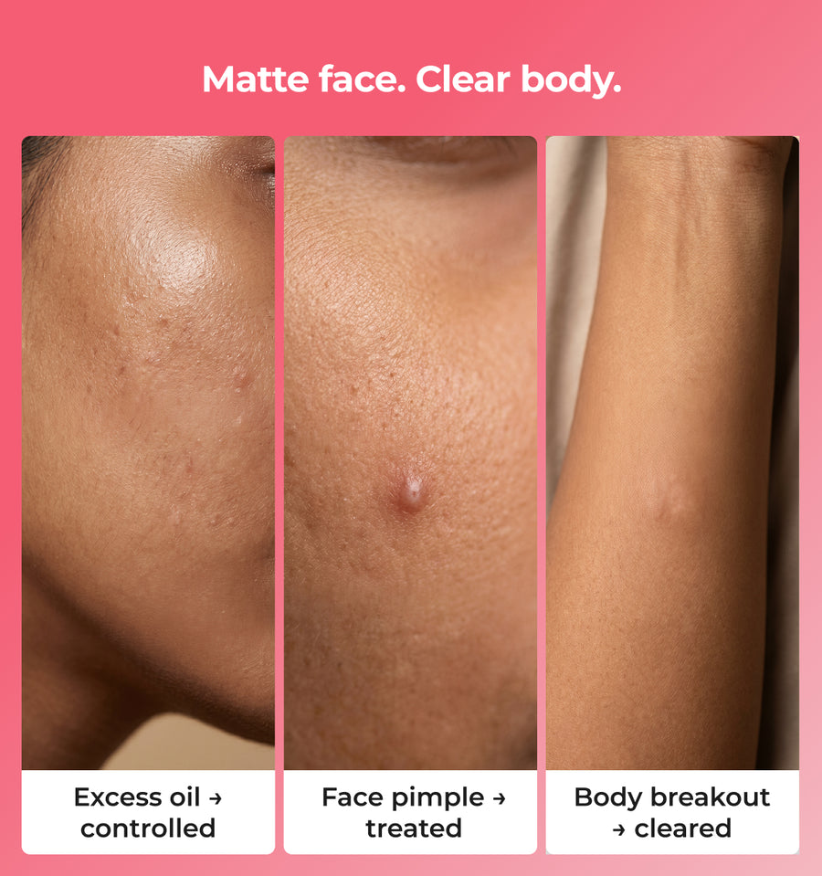 matte face clear body