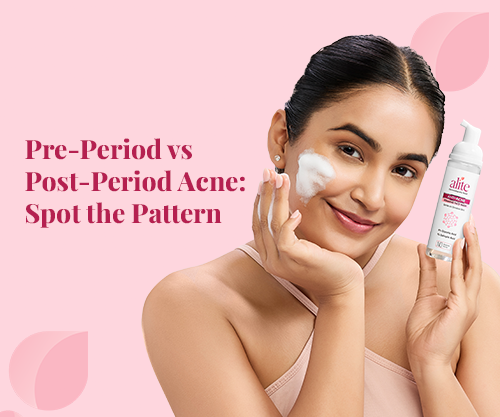 Pre-Period vs Post-Period Acne: Spot the Pattern
